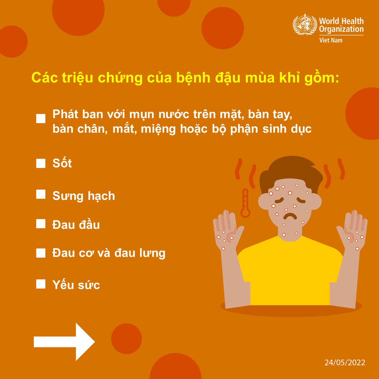Bộ Y tế hướng dẫn cách phòng ngừa lây nhiễm bệnh đậu mùa khỉ tại cơ sở y tế